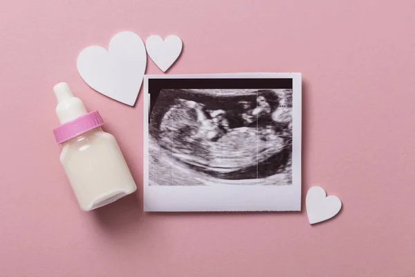 Imagen de ultrasonido de bebé. Concepto de padres expectantes — Foto de Stock