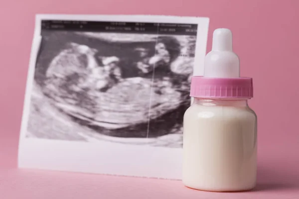 Imagen de ultrasonido de bebé. Concepto de padres expectantes — Foto de Stock