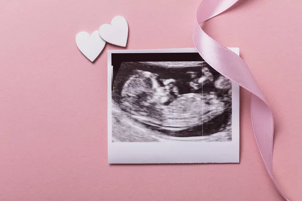 Imagem de ultra-som do bebê. Conceito de pais expectantes — Fotografia de Stock