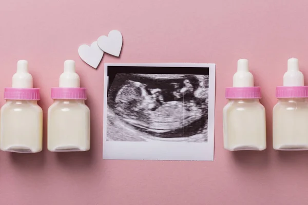 赤ちゃんスキャン超音波写真です。妊娠中の親概念 — ストック写真