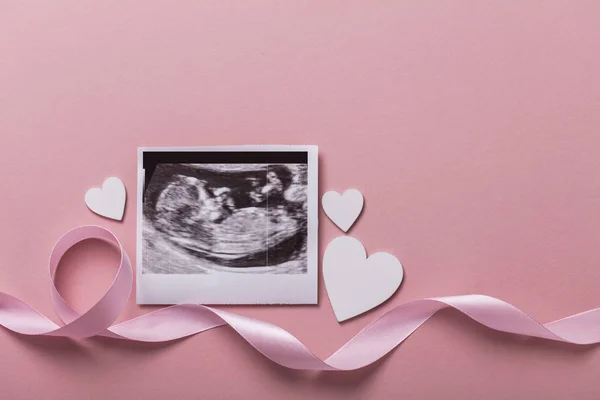 Imagen de ultrasonido de bebé. Concepto de padres expectantes — Foto de Stock