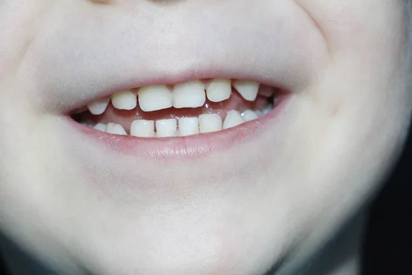 Sorria de um rapazinho. Dentes de cama bebê . — Fotografia de Stock