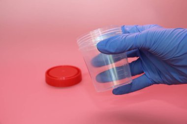 Mavi lateks eldiven bir el idrar toplamak için bir konteyner tutar.