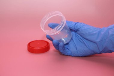 Mavi lateks eldiven bir el idrar toplamak için bir konteyner tutar.