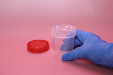 Mavi lateks eldiven bir el idrar toplamak için bir konteyner tutar.