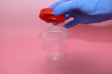 Mavi lateks eldiven bir el idrar toplamak için bir konteyner tutar.