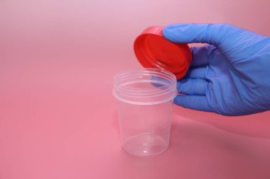 Mavi lateks eldiven bir el idrar toplamak için bir konteyner tutar.