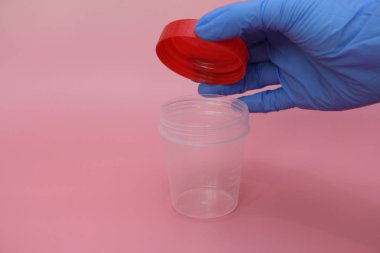 Mavi lateks eldiven bir el idrar toplamak için bir konteyner tutar.