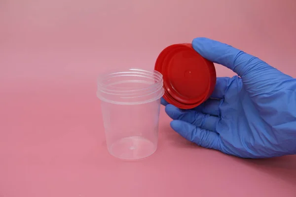 Een hand in een blauwe latex handschoen houdt een container voor het verzamelen van urine. — Stockfoto