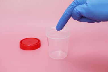 Doktorlar parmak boş bir idrar toplama kavanozu işaret.