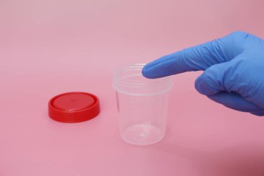 Doktorlar parmak boş bir idrar toplama kavanozu işaret.