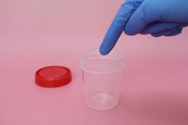 Doktorlar parmak boş bir idrar toplama kavanozu işaret.