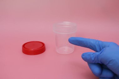 Doktorlar parmak boş bir idrar toplama kavanozu işaret.