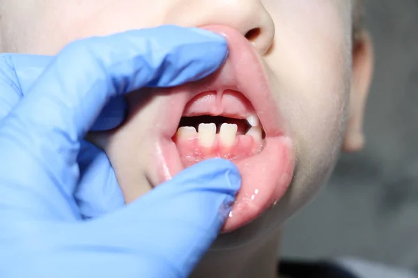Un Dentiste Examine Les Dents Du Bebe Chez Le Garcon La Perte De Dents De Lait Souriez Soins Stock Photo