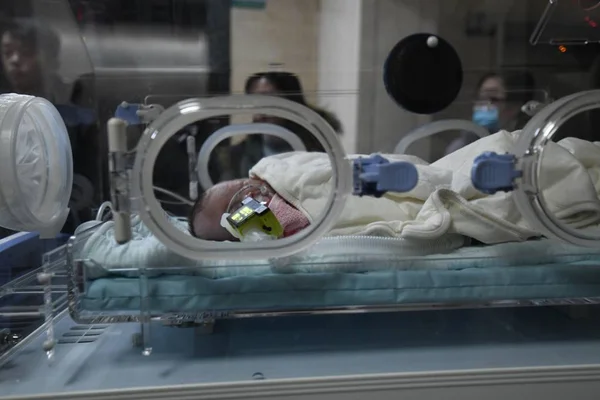 重篤な肺感染を患った800の未熟児である手のひらサイズの赤ちゃんは 中国北京の病院のインキュベーター内で治療を受けており 12月14日2018 — ストック写真