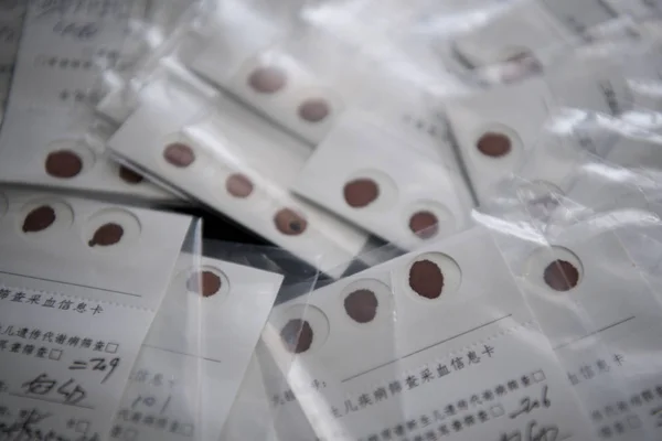 Blood Samples Newborn Infants Collected Disease Screening Lab Shanxi Province — Stockfoto