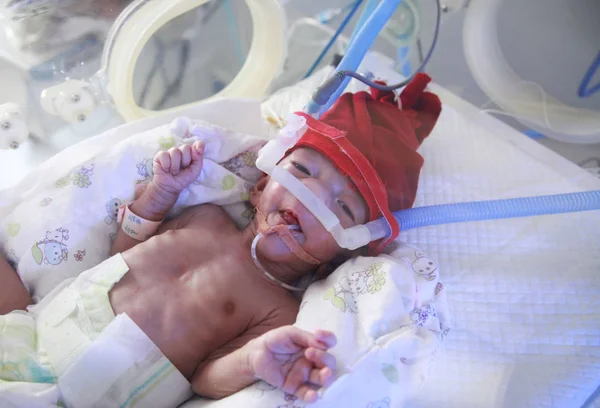 태어난 13일 신생아가 2018년 후베이성 우한시의 후베이 병원에서 인큐베이터에서 치료를 — 스톡 사진