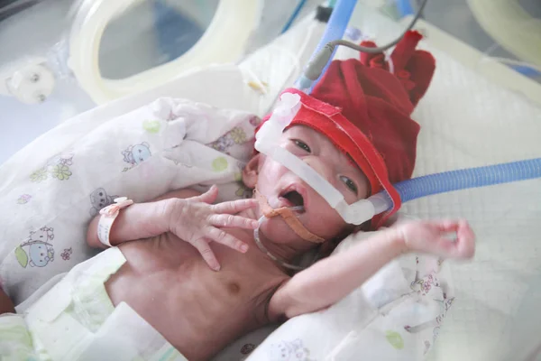 生まれたばかりの赤ちゃんは 生まれてから13日間目を開け続けており 2018年4月9日 中国中部の湖北省武漢市にある湖北母子保健病院のインキュベーターで治療を受けている — ストック写真