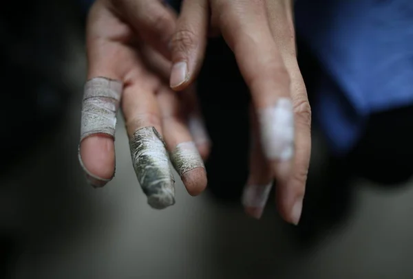 Προβολή Του Υφάσματος Καουτσούκ Τυλιγμένο Στρογγυλά Δάχτυλα Ενός Γυναικείου Υπαλλήλου — Φωτογραφία Αρχείου
