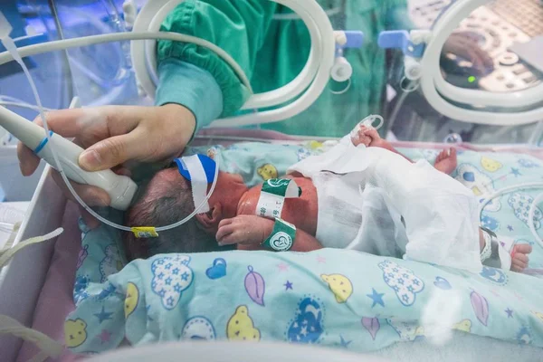 Eines Der Drillinge Einer Jährigen Frau Die Sie Geboren Haben — Stockfoto