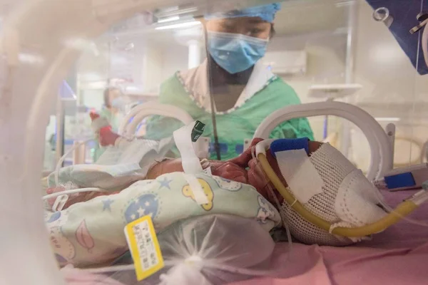 One Girl Triplets Born Year Old Woman You Seen Incubator — Stock Photo, Image