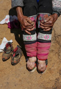 An elderly Chinese woman shows her bound feet in Weining Yi, Hui, and Miao Autonomous county, Bijie city, southwest China's Guizhou province, 19 April 2017 clipart