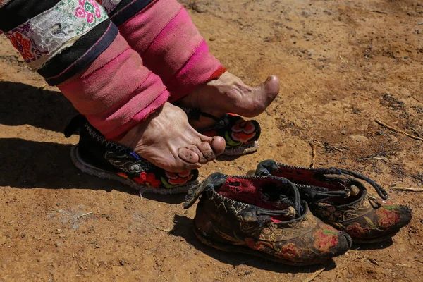 The last bound-feet women of China - in photographs