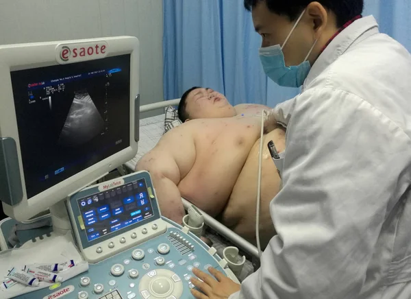 2017年5月10日 中国四川省成都市成都市第三人民医院接受手术减肥检查 据信是中国最重的男子 — 图库照片