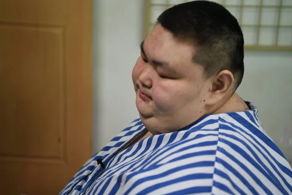 中国で最も重い男性と考えられている26歳の男性黄タオ 中国南西部の四川省成都市の成都第三人民病院で体重を減らす手術の前に描かれています 2017年5月10日 — ストック写真