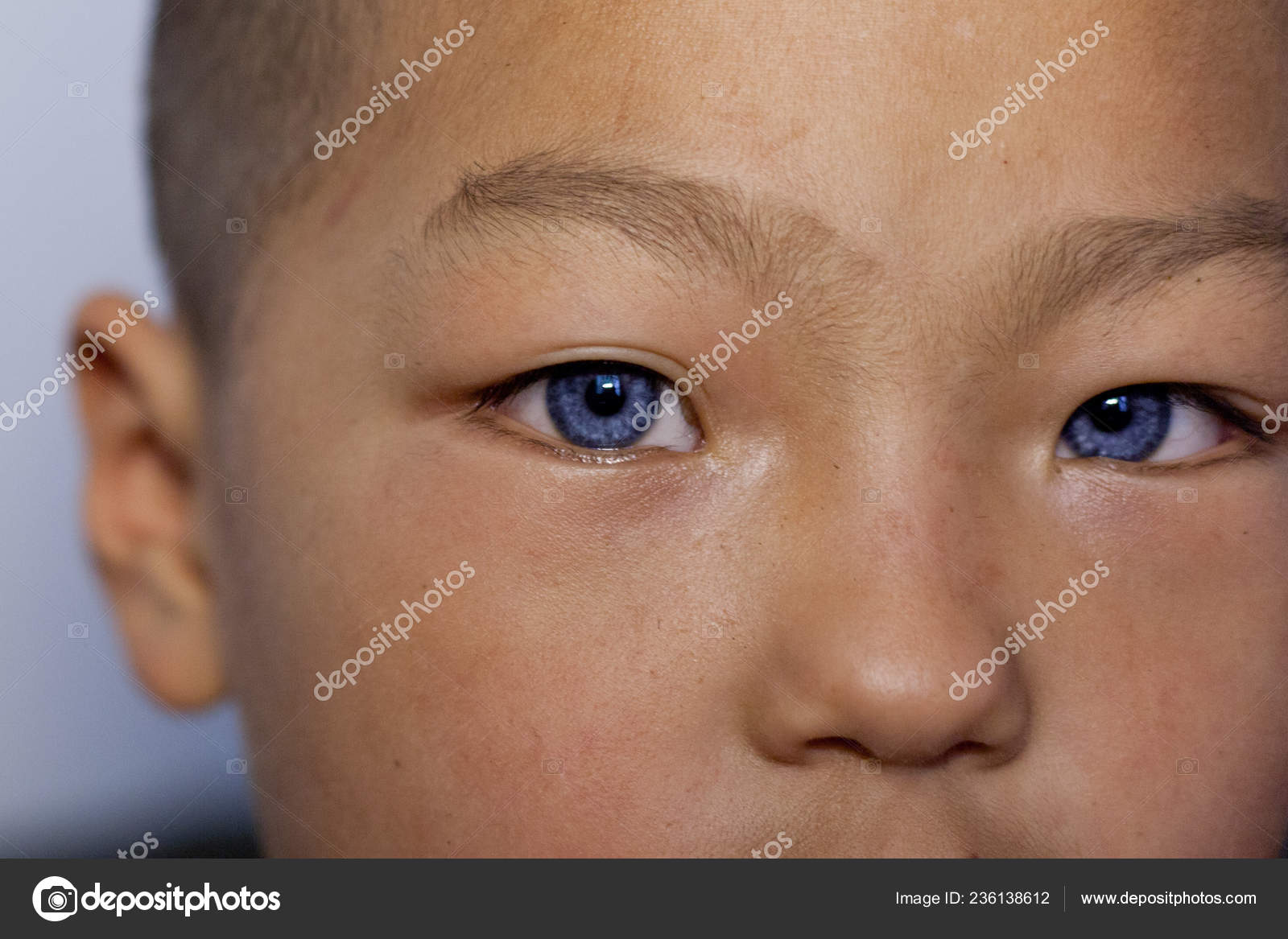 Eight Year Old Chinese Boy Yang Shuntao Who Born Blue Stock Editorial Photo C Chinaimages Eight Year Old Chinese Boy Yang Shuntao Who Born Blue Stock Editorial Photo C Chinaimages