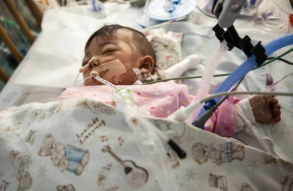 Nyolc Hónapos Baby Sun Menghan Szenved Veleszületett Epeúti Atresia Elhagyott — Stock Fotó