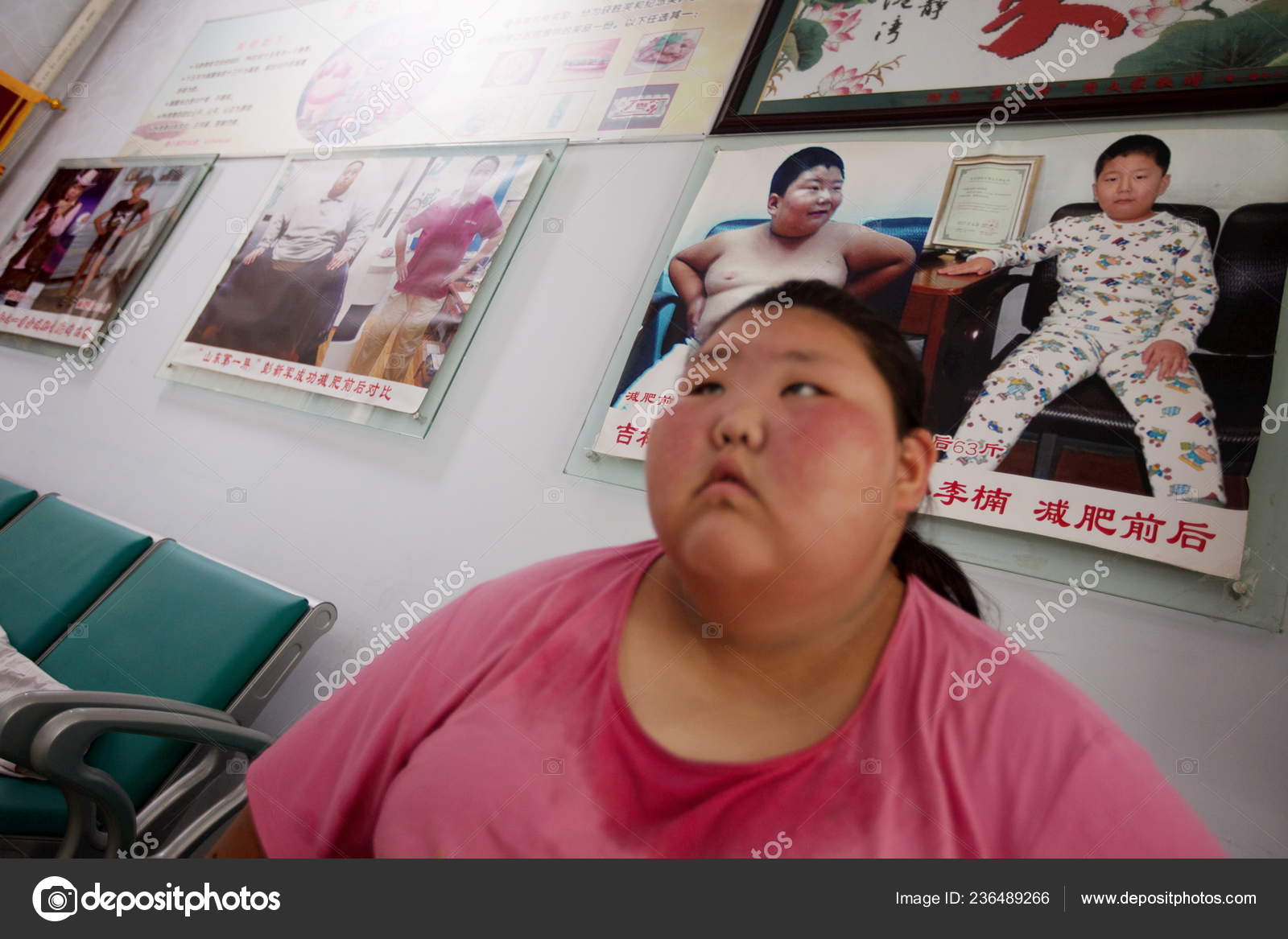 体重165キロの16歳の肥満中国人少女が　中国東部山東省リニ市の脂肪農場に座っている　2016年9月21日　ストックエディトリアル用写真©ChinaImages＃236489266