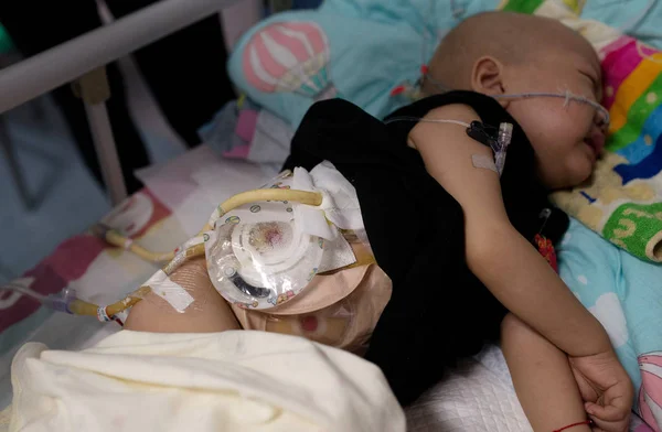Éves Kínai Fiú Haoyang Diagnosztizáltak Hepatoblastoma Nézett Után Nagymamája Bayi — Stock Fotó