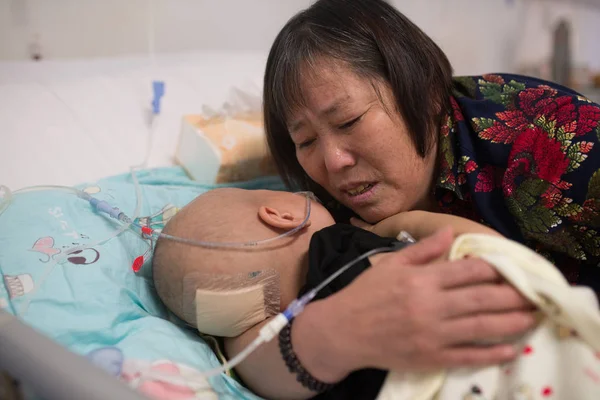 Year Old Chinese Boy Haoyang Diagnosed Hepatoblastoma Looked His Grandmother — Stock Photo, Image