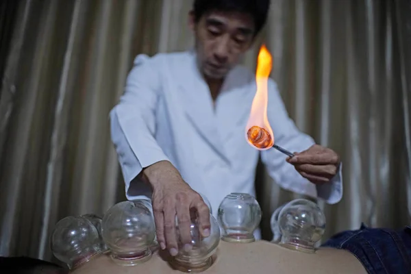Ένας Κινέζος Θεραπευτής Εκτελεί Φωτιά Βεντούζες Στο Πίσω Μέρος Ενός — Φωτογραφία Αρχείου