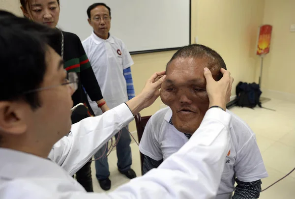 2016年10月25日 中国重慶市の重慶新橋病院で 異星人のような変形した顔をしている中国人村人のXia Yuanhaiが医師の診察を受けている — ストック写真
