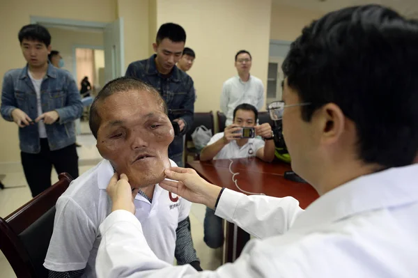 Čínský Villager Xia Yuanhai Který Znetvořené Tváře Kontrolován Lékařem Nemocnici — Stock fotografie