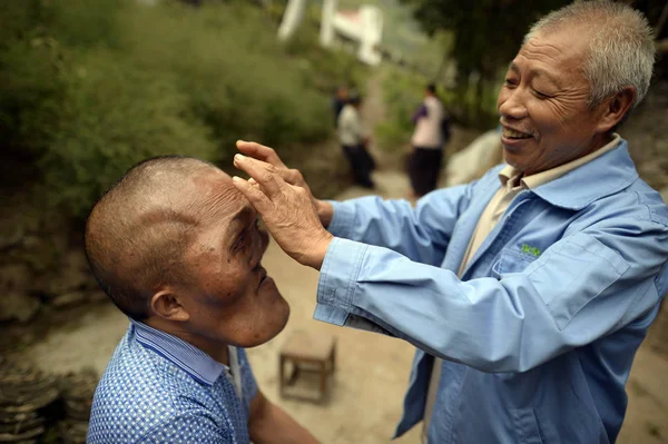 Čínský Vesničan Xia Yuanhai Který Znetvořené Tváře Svým Starším Bratrem — Stock fotografie