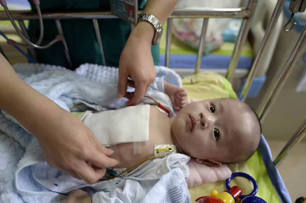 2016年6月20日 在中国重庆医科大学儿童医院做手术前 一名医生在医院治疗患有心脏突出症的新生儿安安 — 图库照片