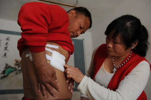 Žena Čínského Muže Liu Yongwei Která Objevila Jeho Pravou Ledvinu — Stock fotografie