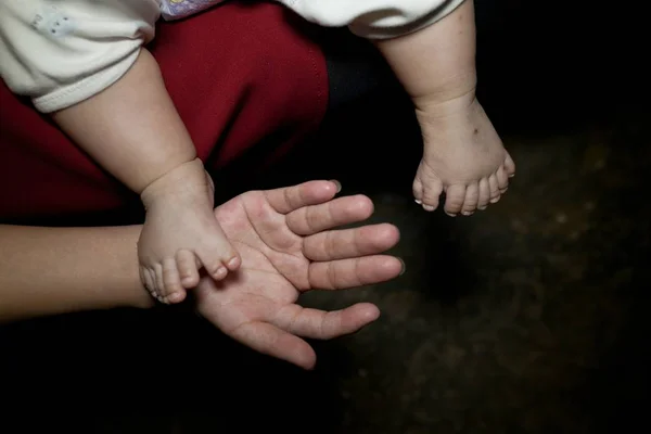 Ребенок на руках. Йоандри эрнандес гарридо. 6 пальцев рождается. Дети с шестью пальцами. Полидактилия генная мутация.