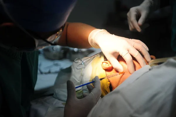 Médico Realiza Una Cirugía Plástica Una Joven Hospital Ciudad Guangzhou — Foto de Stock