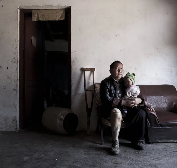 Летний Китайский Крестьянин Ван Милун Этнического Меньшинства Мяо Потерявший Правую — стоковое фото