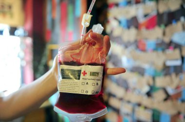 A customer displays a red beverage served in a blood pack at a vampire-inspired cafe in Benxi city, northeast Chinas Liaoning province, 6 July 2014 clipart