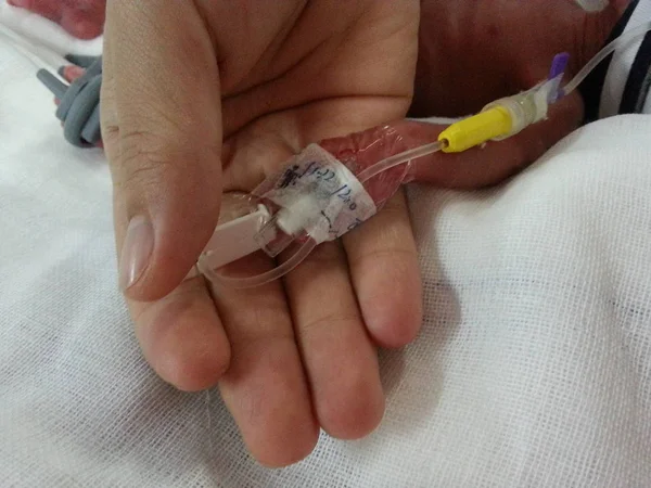 Chińska Pielęgniarka Porównuje Rękę Jednym 650G Noworodka Bliźniak Dziecko Otrzymujących — Zdjęcie stockowe