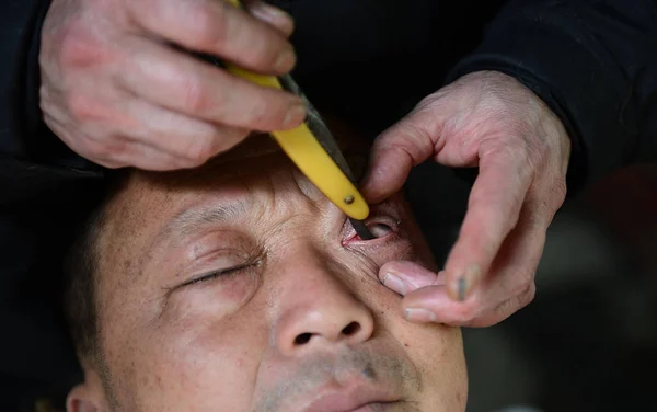 Barber Liudeyuan Rengöring Kunder Ögon Park Chengdu City Västra Chinas — Stockfoto