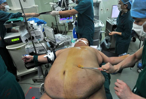 Chinesische Ärzte Bereiten Sich Während Einer Magenschnitt Operation Einem Krankenhaus — Stockfoto