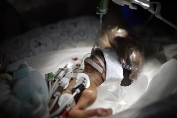 Čínský Lékař Stará Čínských Nejmenší Dítě Přezdívaný Hůlky Baby Inkubátoru — Stock fotografie
