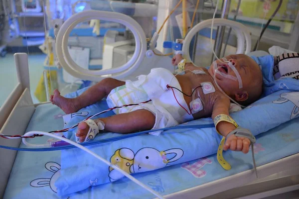 Peng Ankang Baby Whose Weight 8Kg Born June Being Treated — Stock Photo, Image