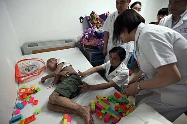Lékaři Zkoumat Kůži Pan Xianhang 8Letý Chlapec Který Tvaru Fishskin — Stock fotografie